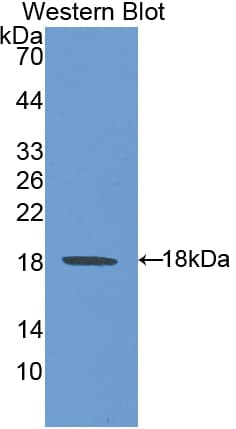 HSPH1 / HSP105 Antibody (aa595-733)