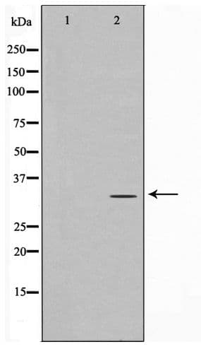 ELOVL1 Antibody