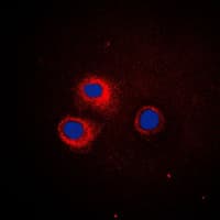 CD1E Antibody (Internal)