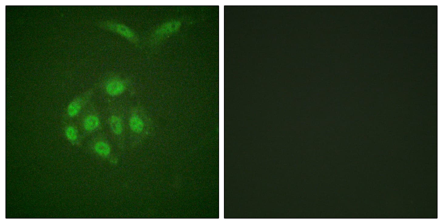 BIRC5 / Survivin Antibody (phospho-Thr117)