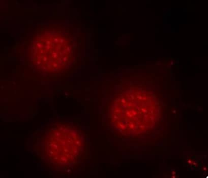 Polyclonal Rabbit anti-Human FOXO4 / AFX1 Antibody (phospho-Ser197, IHC, IF, WB)