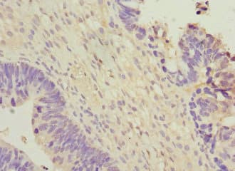 Polyclonal Rabbit anti-Human WNT7B Antibody (IHC, WB)