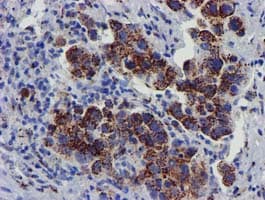 FXN / Frataxin Antibody (clone OTI1C12)