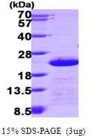 Human CETN2 / Centrin 2 Protein (Recombinant His)
