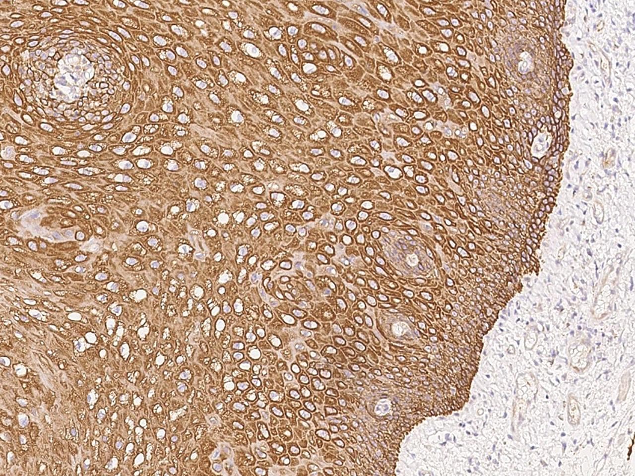 Polyclonal Rabbit anti-Human KRT24 / Keratin 24 Antibody (IHC)