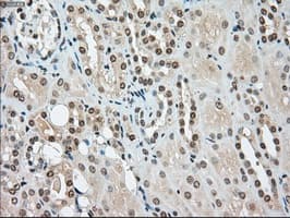 SSB / La Antibody (clone OTI2C8)