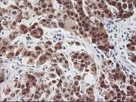 HSPBP1 Antibody (clone OTI1D5)