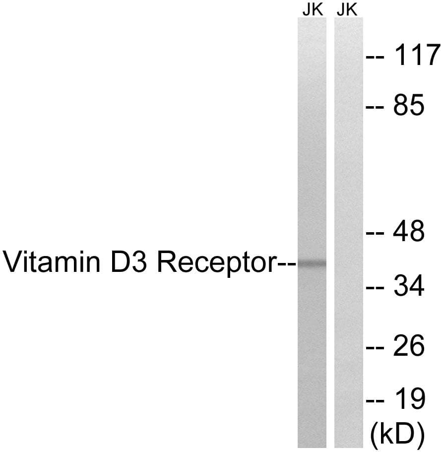 Vitamin D Receptor / VDR Antibody (p51)
