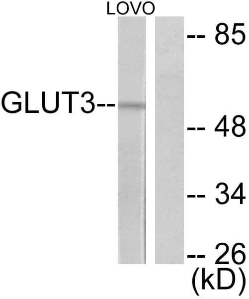 IHC-plus™ SLC2A3 / GLUT3 Antibody (aa447-496)