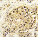 Polyclonal Rabbit anti-Human SENP3 Antibody (aa1-30, IHC, WB)