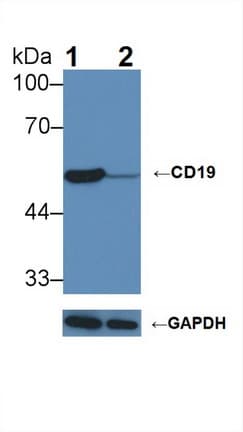 Polyclonal Rabbit anti-Mouse CD19 Antibody (aa19-287, WB)