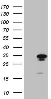 Monoclonal Mouse anti-Human GTPCH1 / GCH1 Antibody (clone OTI7B8, Carrier-free, IHC, WB)