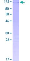 Human TSPYL2 / DENTT Protein (Recombinant GST)