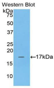 ADM / Adrenomedullin Antibody (aa35-171)