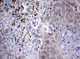 Monoclonal Mouse anti-Human PIK3C2A Antibody (clone OTI11D6, aa230-560, IHC, WB)
