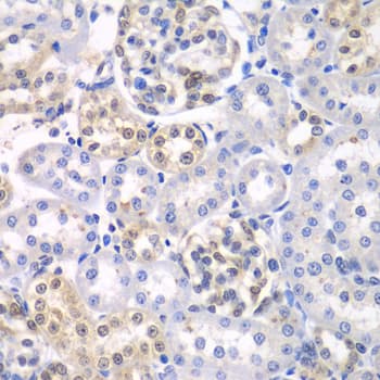 Polyclonal Rabbit anti-Human HDAC2 Antibody (IHC, IF, WB)