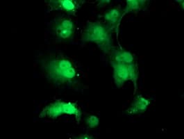 TPRKB Antibody (clone OTI3H3)
