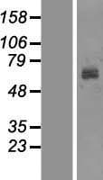 Human Tyrosinase Protein (Over-Expression Lysate Myc-DDK (Flag))