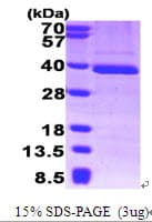 Human TFIIB Protein (Recombinant His)