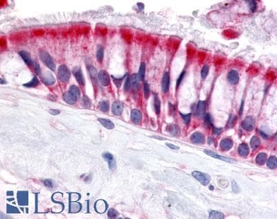 PathPlus™ OR6N1 Antibody (Extracellular Domain)