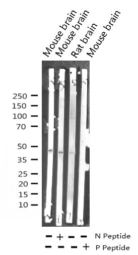 Polyclonal Rabbit anti-Human AURKA / Aurora-A Antibody (phospho-Thr288, IHC, IF, WB)