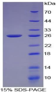 Mouse GJA1 / CX43 / Connexin 43 Protein (Recombinant His, N-Terminal)
