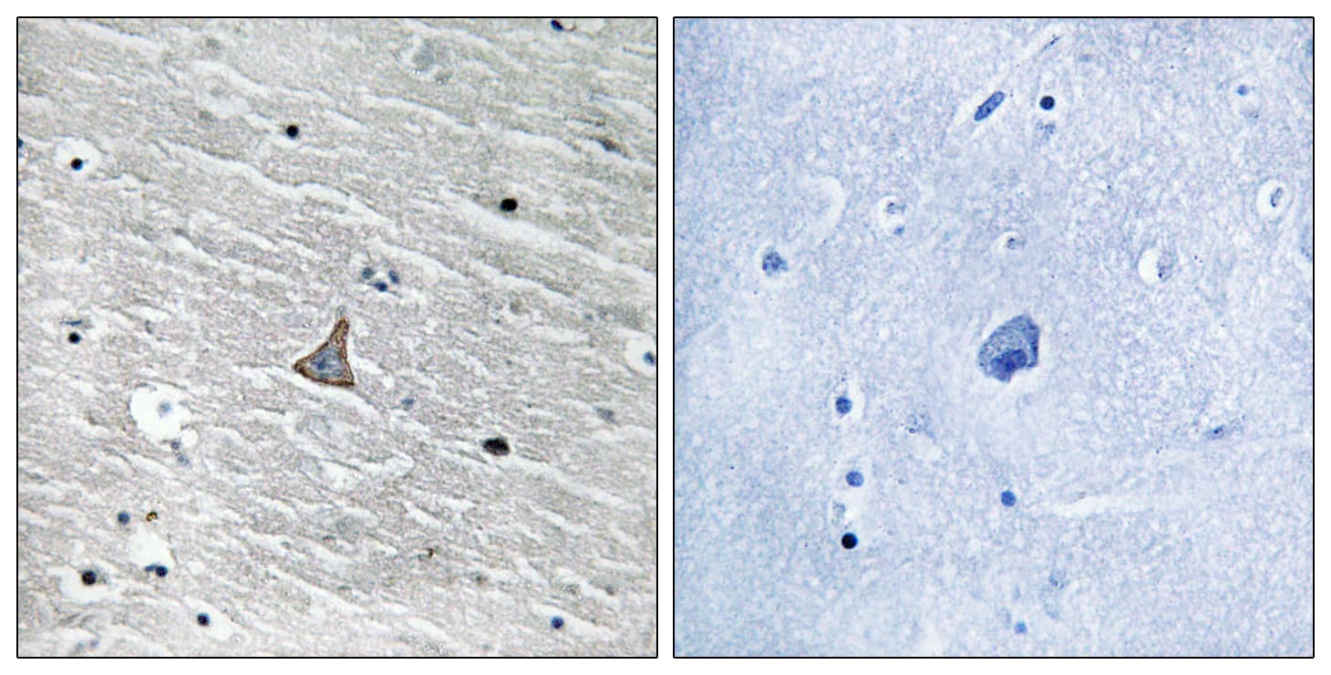 VHL / Von Hippel Lindau Antibody