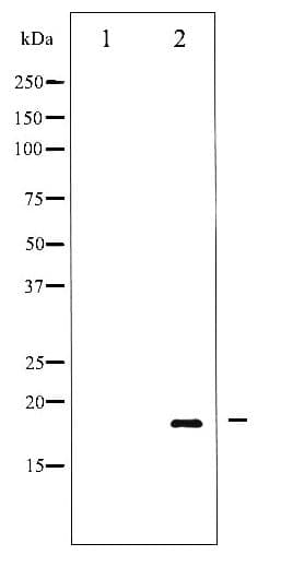 SNCA / Alpha-Synuclein Antibody (phospho-Tyr136)
