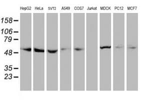 TUBAL3 Antibody (aa150-446, clone OTI4D9, Carrier-free)