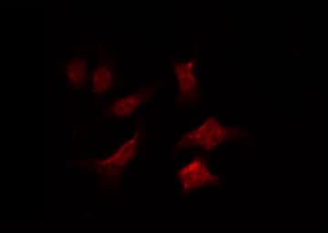 FZD6 / Frizzled 6 Antibody