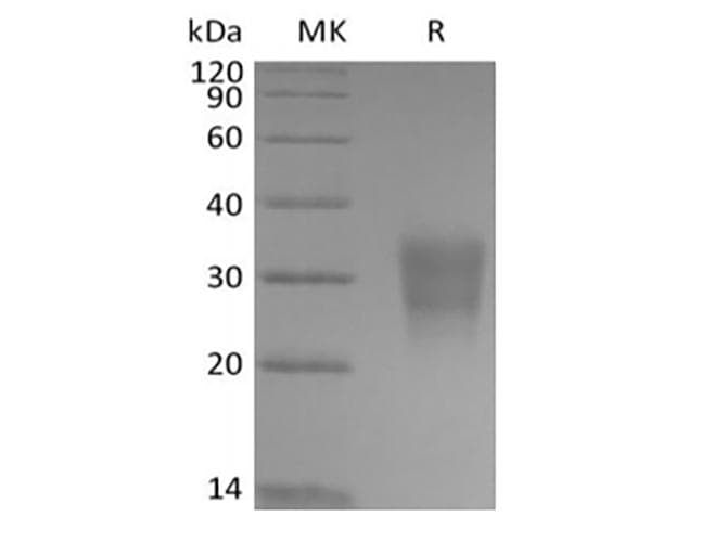 Human FZD8 / Frizzled 8 Protein (Recombinant AVI-6His, C-terminus)