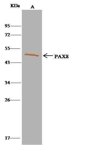 PAX8 Antibody (Preservative Free)