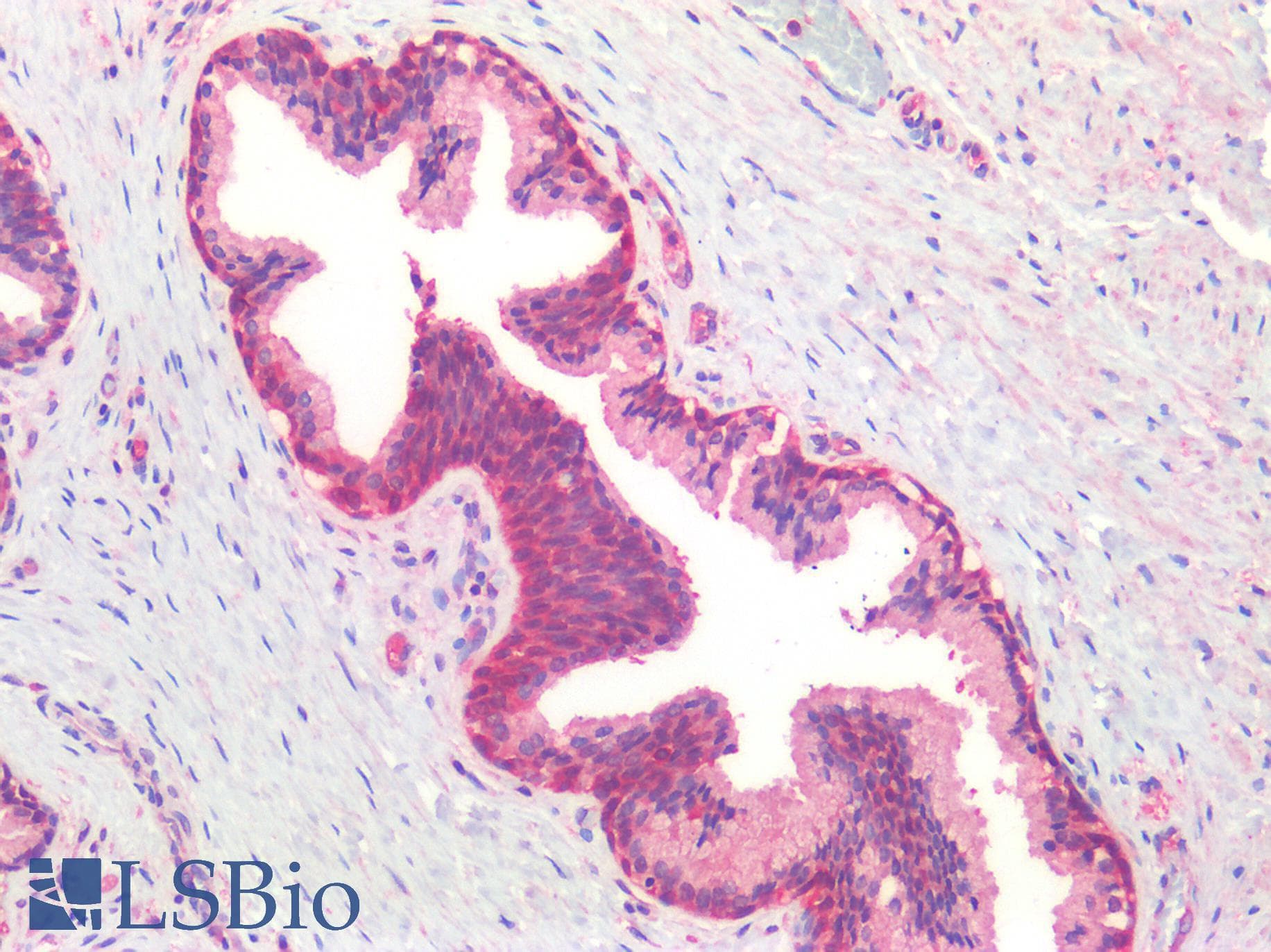IHC-plus™ Polyclonal Rabbit anti-Human ROR1 Antibody (C-terminal, IHC)
