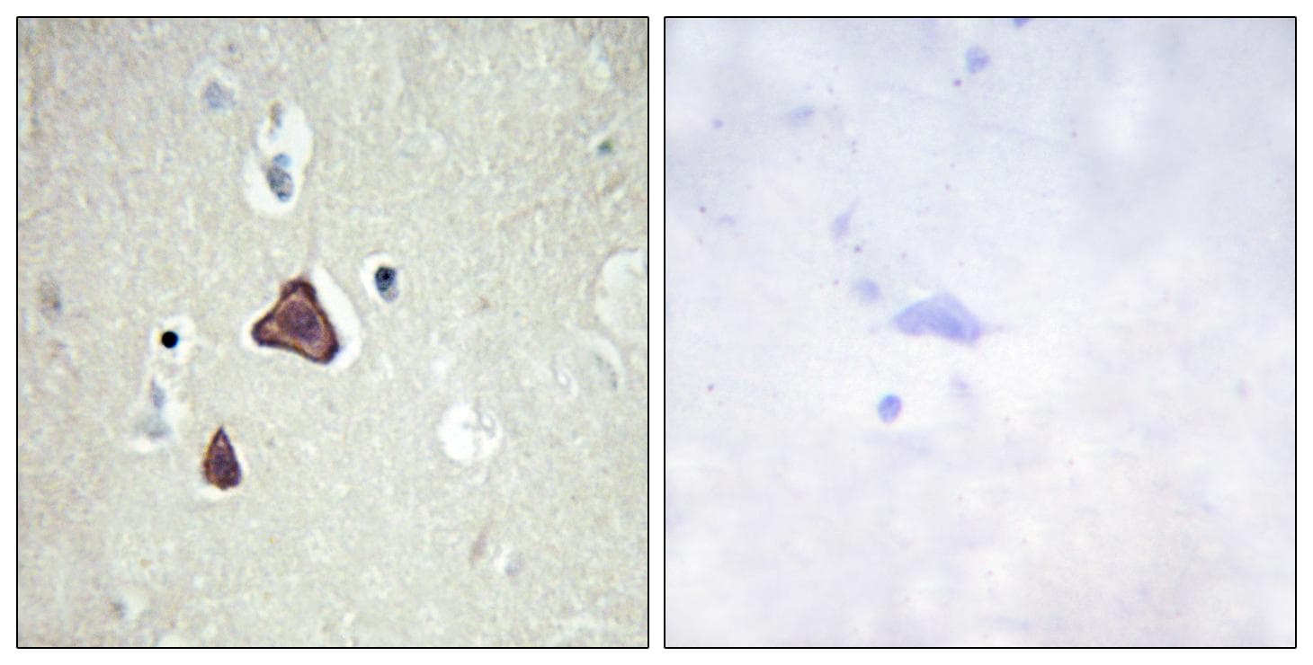 Polyclonal Rabbit anti-Human ADCY8 / Adenylate Cyclase 8 Antibody (IHC, IF)