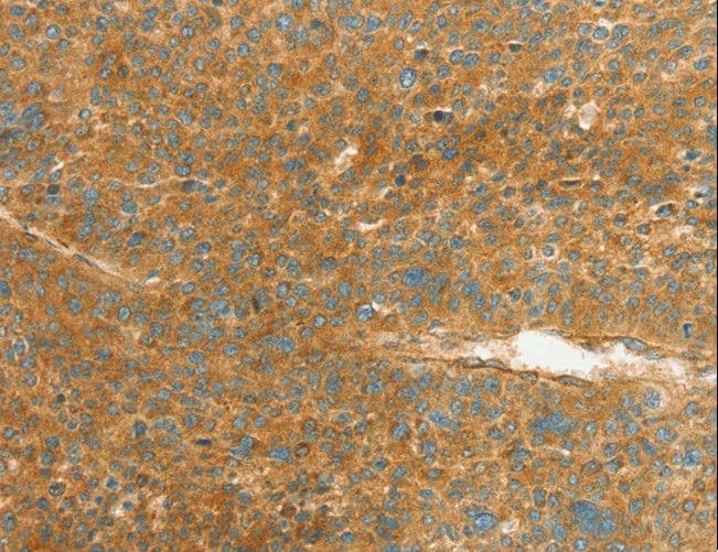 IHC-plus™ APOL2 / Apolipoprotein L 2 Antibody