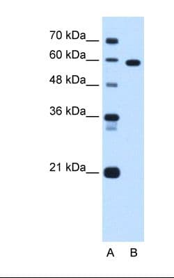 Polyclonal Rabbit anti-Human TBX15 Antibody (aa412-461, IHC, WB)