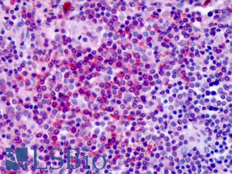 PathPlus™ Polyclonal Rabbit anti-Human GPER1 / GPR30 Antibody (Extracellular Domain, IHC)