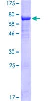 Human ARRDC4 Protein (Recombinant GST)