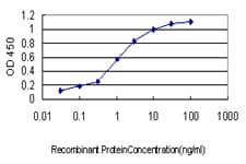 PSMB2 Antibody (clone M1)