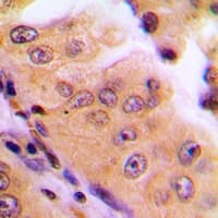 RACGAP1 / MGCRACGAP Antibody (Internal)