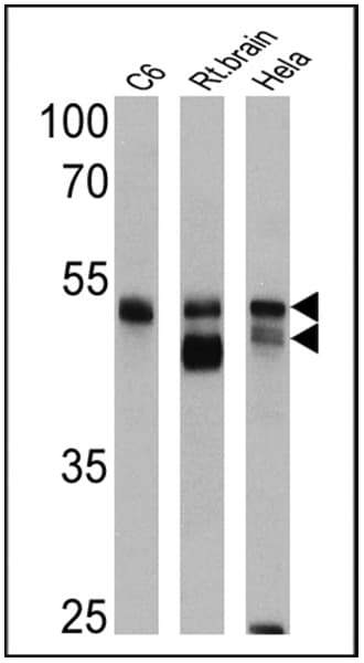 Polyclonal Rabbit anti-Human ARRB1 + ARRB2 Antibody (IHC, WB)