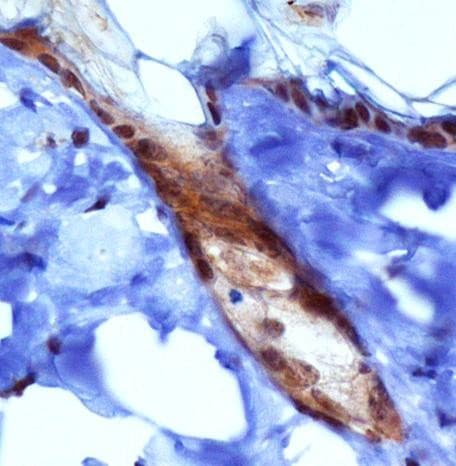 PIEZO1 / FAM38A Antibody