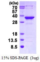 Human MMACHC Protein (Recombinant His)