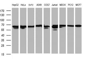 HSPD1 / HSP60 Antibody (clone OTI6F7)