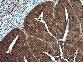 PIK3R5 Antibody (clone OTI5B1)