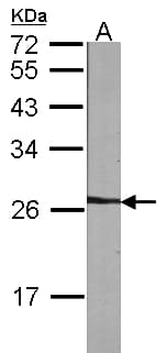 NME5 Antibody (aa1-212)