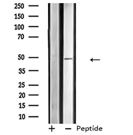CRHR2 / CRF2 Receptor Antibody