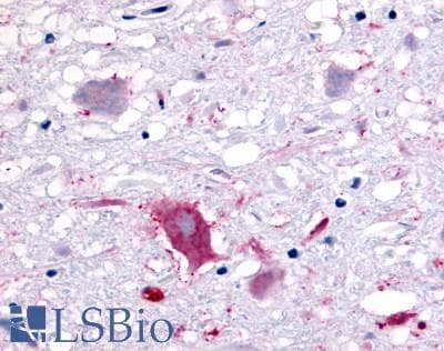 PathPlus™ GPR32 Antibody (Extracellular Domain)