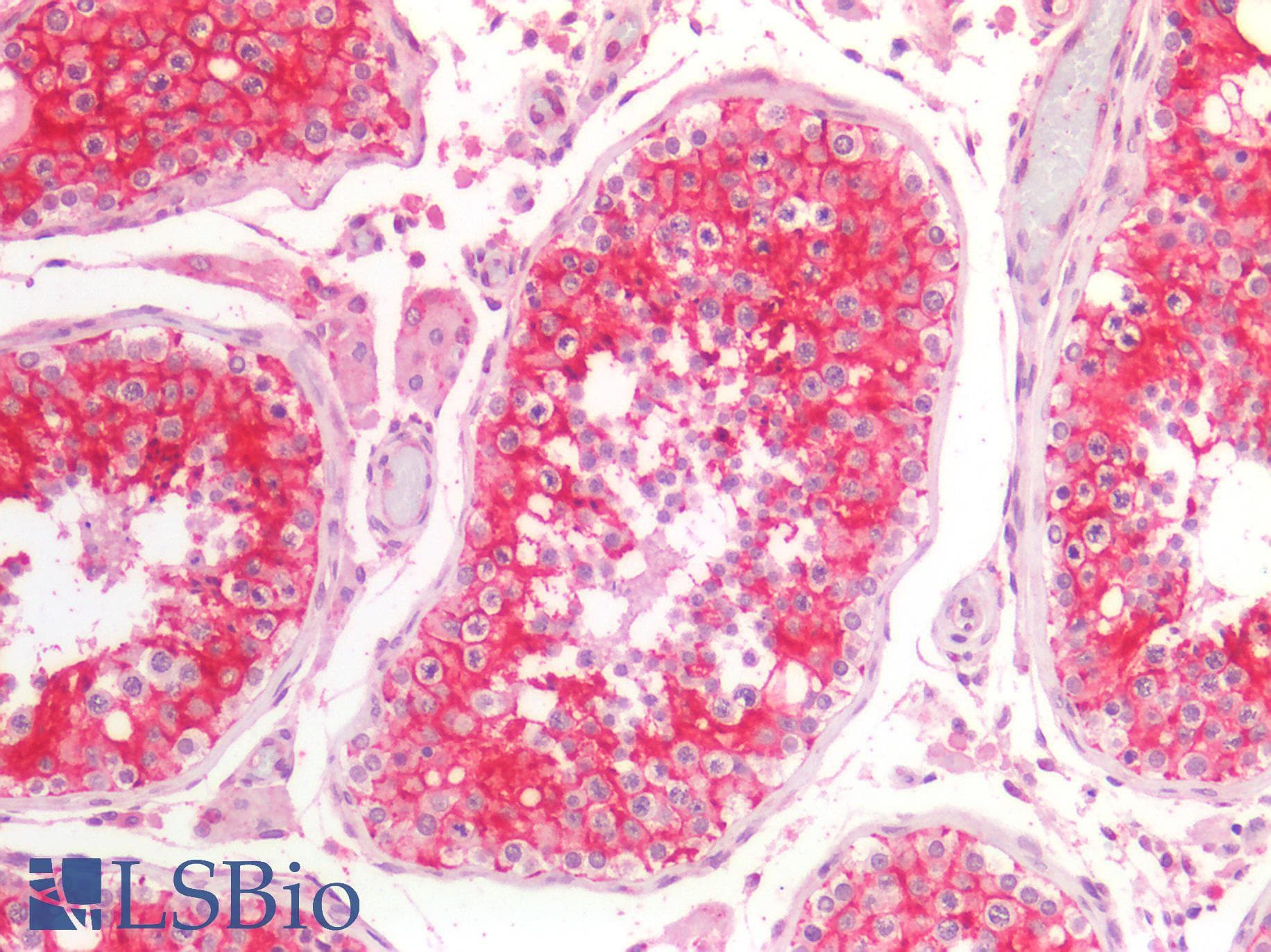 PathPlus™ NDRG1 Antibody (aa382-394)