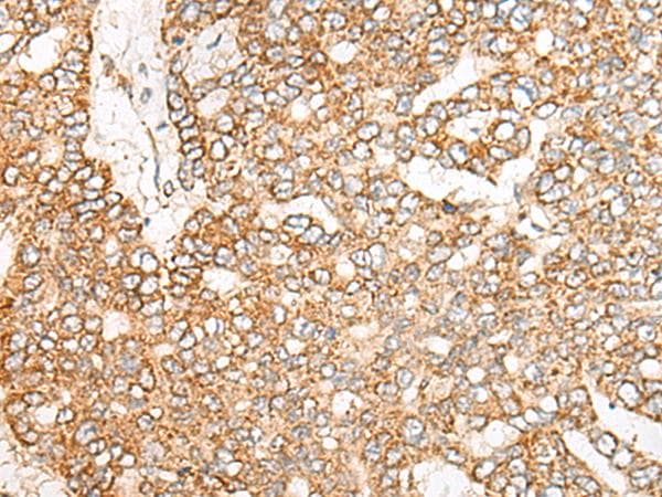 NME4 Antibody
